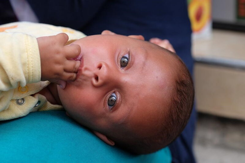 Zoom sur l’autisme atypique, caractéristiques et traitement.